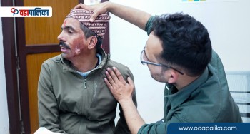 सुदुरपश्चिम प्रदेशका स्थानीय तहका नागरिकले पाए जलनको निःशुल्क उपचार