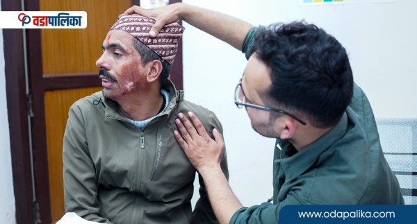 सुदुरपश्चिम प्रदेशका स्थानीय तहका नागरिकले पाए जलनको निःशुल्क उपचार