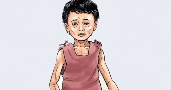 कुपोषण हुने बालबालिको संख्यामा वृद्धि