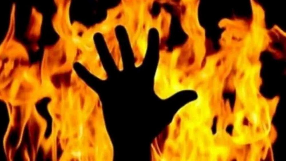आत्मदाहको कोशिस गरेका नेपालीलाई थप उपचारका लागि भारत लैजाने तयारी